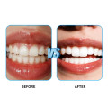 B40 HT Lithium Disilicate Blocks Cubes Glass Ceramic Blocks 4Pcs for Sirona Cerec CAD/CAM - Image 6