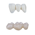 High Translucency White Zirconia Block for 89mm Amann Girrbach System - Image 2