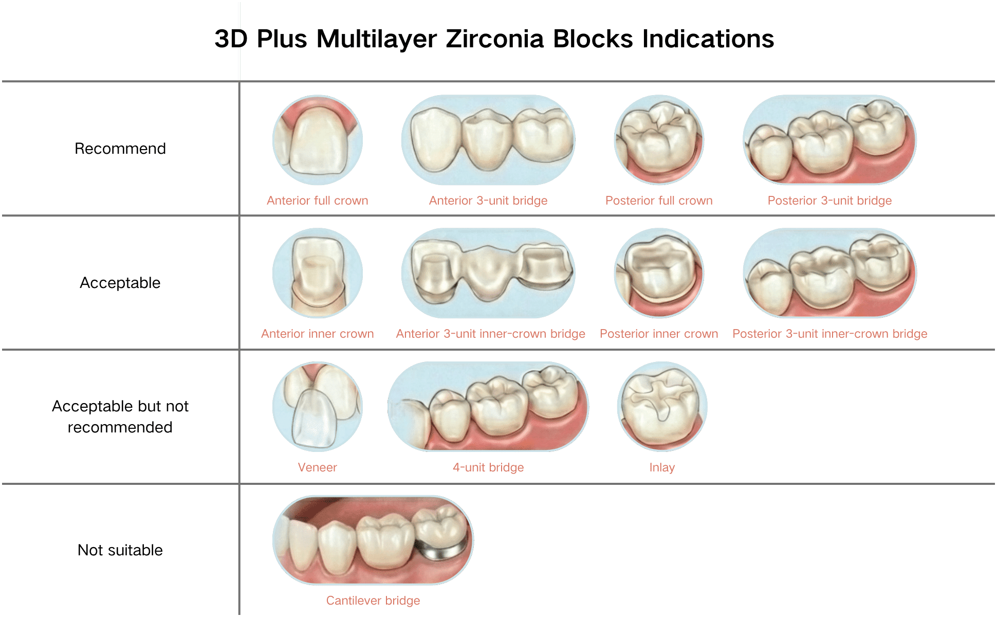 3D Plus Multilayer Zirconia Indications